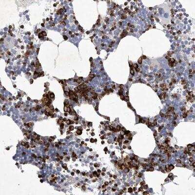 Immunohistochemistry-Paraffin: Siglec-10 Antibody [NBP1-82759]