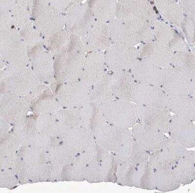 Immunohistochemistry-Paraffin: Siglec-10 Antibody [NBP1-82759]