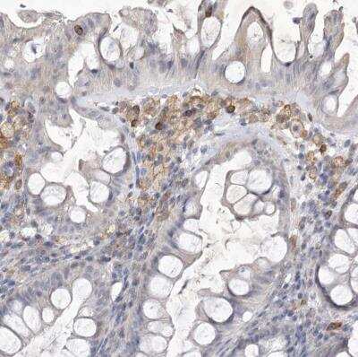 Immunohistochemistry-Paraffin: Siglec-10 Antibody [NBP1-82759]