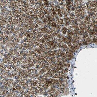 Immunohistochemistry-Paraffin: Siglec-14 Antibody [NBP1-91117]