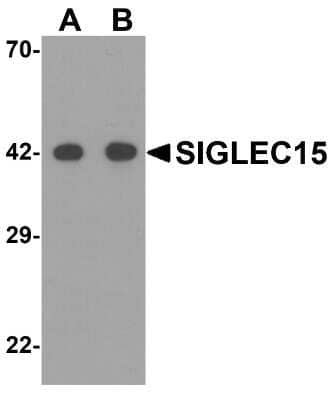 Western Blot: Siglec-15 AntibodyBSA Free [NBP2-41162]