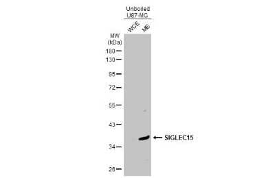 Western Blot: Siglec-15 Antibody [NBP3-13465]