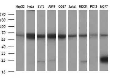 Western Blot: Siglec-2/CD22 Antibody (OTI1F12) [NBP2-46125]