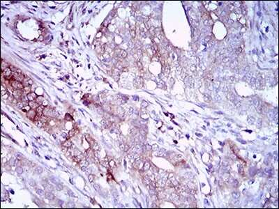 Immunohistochemistry-Paraffin: Siglec-2/CD22 Antibody (2H1C4) - BSA Free [NBP2-37327]
