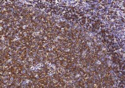 Immunohistochemistry-Paraffin: Siglec-2/CD22 Antibody (340) [NBP2-90030]