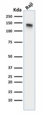 Western Blot: Siglec-2/CD22 Antibody (BLCAM/1795)Azide and BSA Free [NBP2-54473]