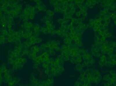 Immunocytochemistry/ Immunofluorescence: Siglec-2/CD22 Antibody (OTI1F12) - Azide and BSA Free [NBP2-74186]