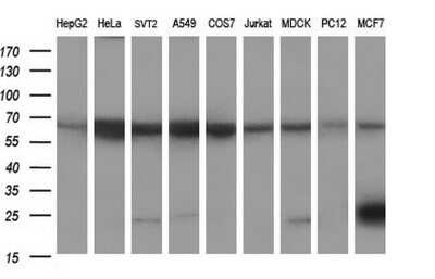 Western Blot: Siglec-2/CD22 Antibody (OTI1F12)Azide and BSA Free [NBP2-74186]