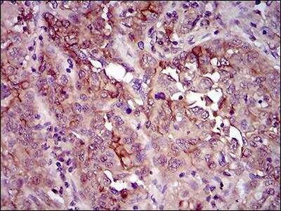 Immunohistochemistry: Siglec-3/CD33 Antibody (2C6B7) - BSA Free [NBP2-37388]