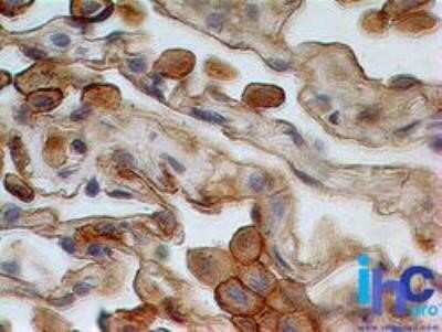 Immunohistochemistry: Siglec-3/CD33 Antibody (44M12D3) - Azide and BSA Free [NBP2-80948]