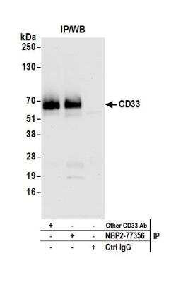 Immunoprecipitation: Siglec-3/CD33 Antibody (BLR061G) [NBP2-77356]