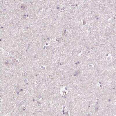 Immunohistochemistry-Paraffin: Siglec-6/CD327 Antibody [NBP1-85756]