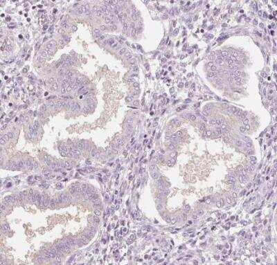 Immunohistochemistry-Paraffin: Siglec-6/CD327 Antibody [NBP1-85756]