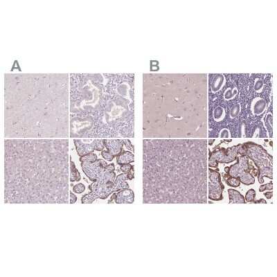 Immunohistochemistry-Paraffin: Siglec-6/CD327 Antibody [NBP1-85756]