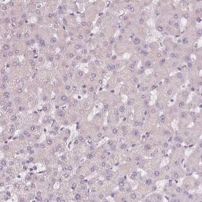 Immunohistochemistry-Paraffin: Siglec-6/CD327 Antibody [NBP1-85756]