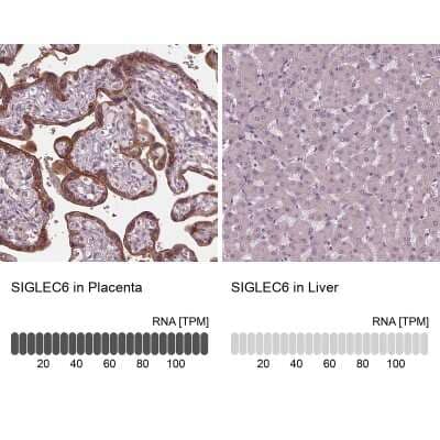 Immunohistochemistry-Paraffin: Siglec-6/CD327 Antibody [NBP1-85757]