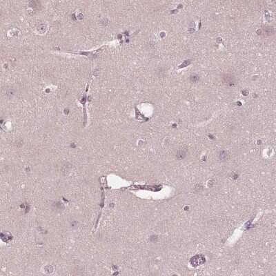 Immunohistochemistry-Paraffin: Siglec-6/CD327 Antibody [NBP1-85757]