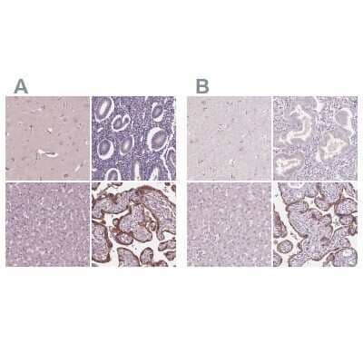 Immunohistochemistry-Paraffin: Siglec-6/CD327 Antibody [NBP1-85757]