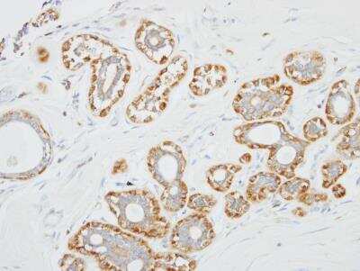 Immunohistochemistry-Paraffin: Siglec-8 Antibody [NBP1-31141]