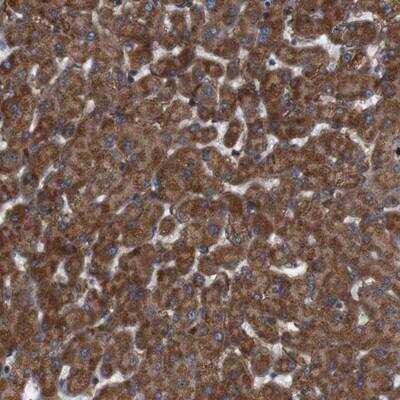Immunohistochemistry-Paraffin: Siglec-8 Antibody [NBP1-82666]