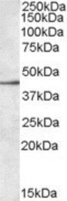 Western Blot: Siglec-8 Antibody [NBP1-06078]