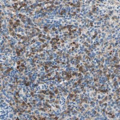 Immunohistochemistry-Paraffin: Siglec-9 Antibody [NBP1-85755]