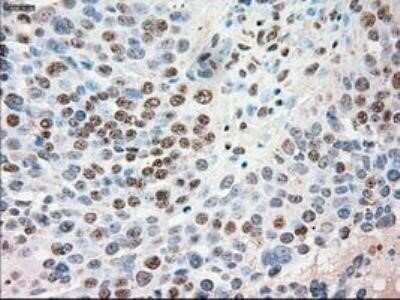 Immunohistochemistry: Siglec-9 Antibody (OTI1D9) - Azide and BSA Free [NBP2-74189]