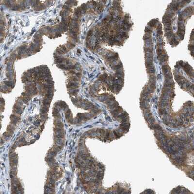 Immunohistochemistry-Paraffin: Sigma-1 R/OPRS1 Antibody [NBP1-82479]
