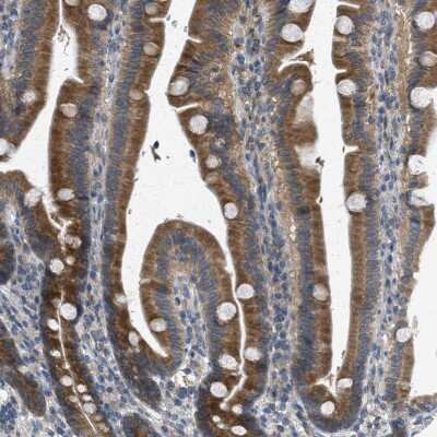 Immunohistochemistry-Paraffin: Sigma-1 R/OPRS1 Antibody [NBP1-82479]