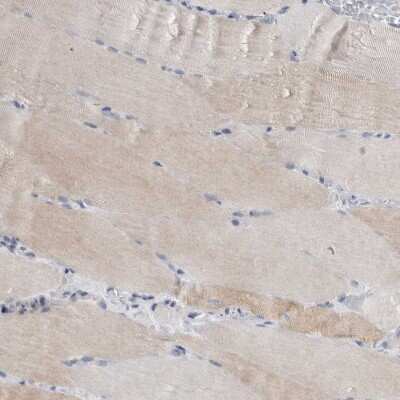 Immunohistochemistry-Paraffin: Sigma-1 R/OPRS1 Antibody [NBP1-82480]