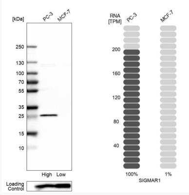 Western Blot: Sigma-1 R/OPRS1 Antibody [NBP1-82479]