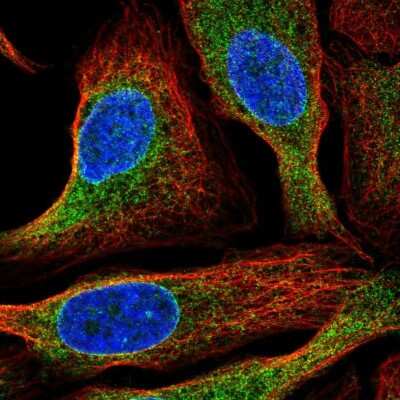 Immunocytochemistry/ Immunofluorescence: Signal Peptide Peptidase Antibody [NBP2-54935]