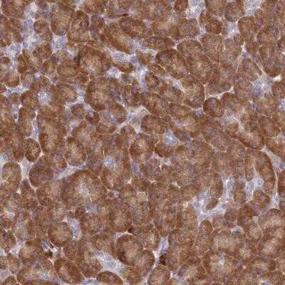 Immunohistochemistry-Paraffin: Signal Peptide Peptidase Antibody [NBP1-92389]