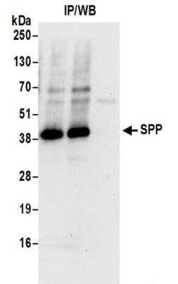 Immunoprecipitation: Signal Peptide Peptidase Antibody [NBP2-32276]