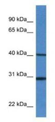 Western Blot: Signal Peptide Peptidase Antibody [NBP1-74111]