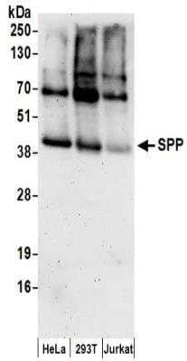 Western Blot: Signal Peptide Peptidase Antibody [NBP2-32276]