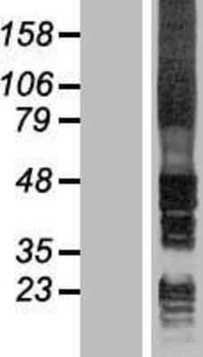 Western Blot: Signal Peptide Peptidase Overexpression Lysate [NBL1-11602]