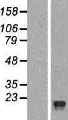 Western Blot: Signal Peptide Peptidase Overexpression Lysate [NBP2-04949]