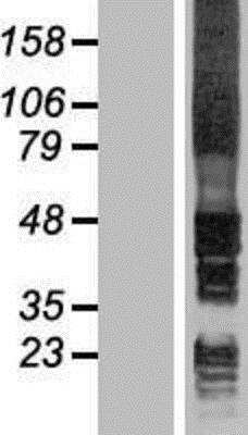 Western Blot: Signal Peptide Peptidase Overexpression Lysate [NBP2-09921]