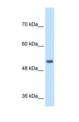 Western Blot: Signal peptide peptidase-like 2B Antibody [NBP1-59510]