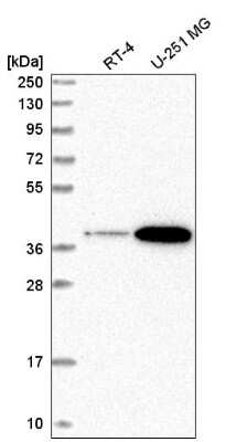 Western Blot: Signal peptide peptidase-like 2B Antibody [NBP2-55073]