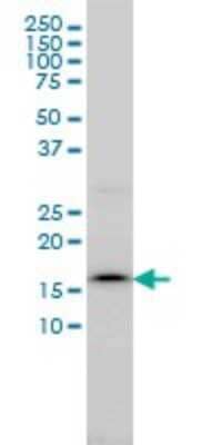 Western Blot: Signal sequence receptor delta Antibody (2D3) [H00006748-M01]