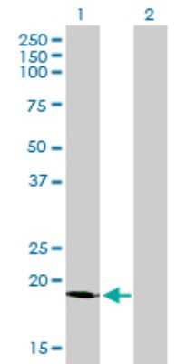Western Blot: Signal sequence receptor delta Antibody (2D3) [H00006748-M01]