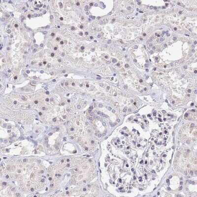 Immunohistochemistry-Paraffin: Signal sequence receptor delta Antibody [NBP1-92390]
