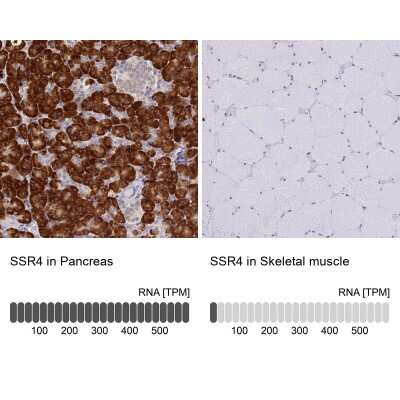 Immunohistochemistry-Paraffin: Signal sequence receptor delta Antibody [NBP1-92390]