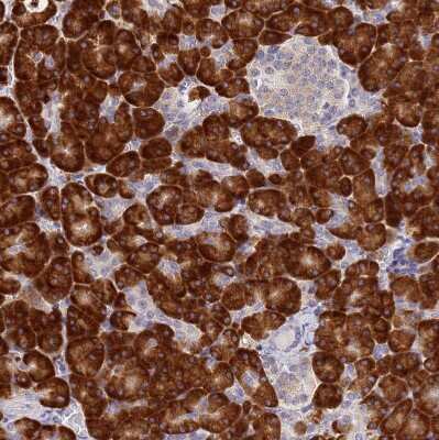Immunohistochemistry-Paraffin: Signal sequence receptor delta Antibody [NBP1-92390]