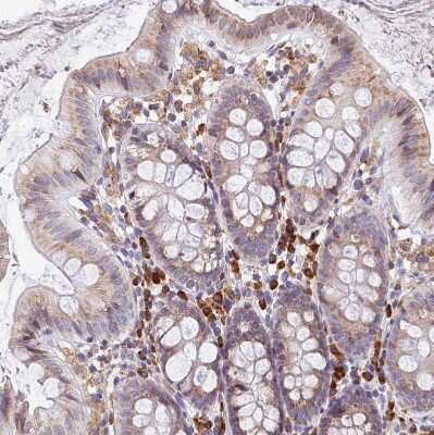 Immunohistochemistry-Paraffin: Signal sequence receptor delta Antibody [NBP1-92390]