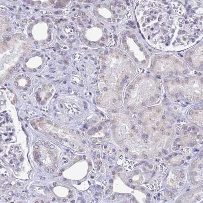 Immunohistochemistry-Paraffin: Signal sequence receptor delta Antibody [NBP1-92390]