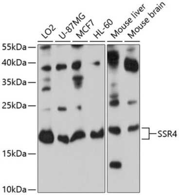 Western Blot: Signal sequence receptor delta AntibodyBSA Free [NBP2-93752]