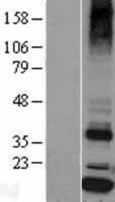 Western Blot: Signal sequence receptor delta Overexpression Lysate [NBL1-16475]